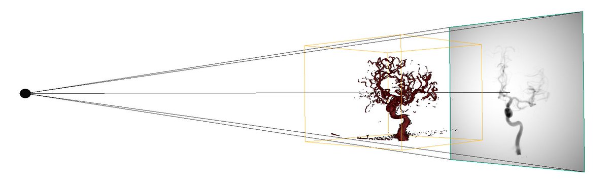 FraunhoferMEVIS's tweet photo. Improving 2D–3D #ImageRegistration using Normalized Gradient Fields for image-guided endovascular therapy: Find out more in our talk at @BVM_workshop 2020 in #Berlin. https://t.co/L616creC1a #BVM2020 https://t.co/rIEvB5vgBp