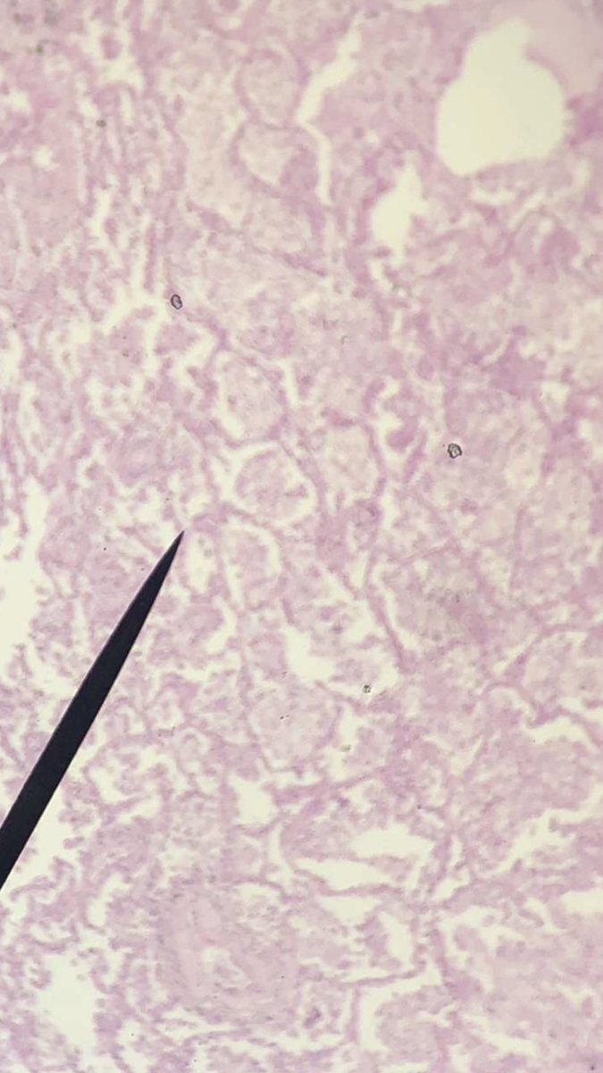 Jessica27555291's tweet photo. Cancer cells and cell development stages! #106Week9ACS20 
@UNKBIOl1069ACS20 https://t.co/HqQnskaQx5