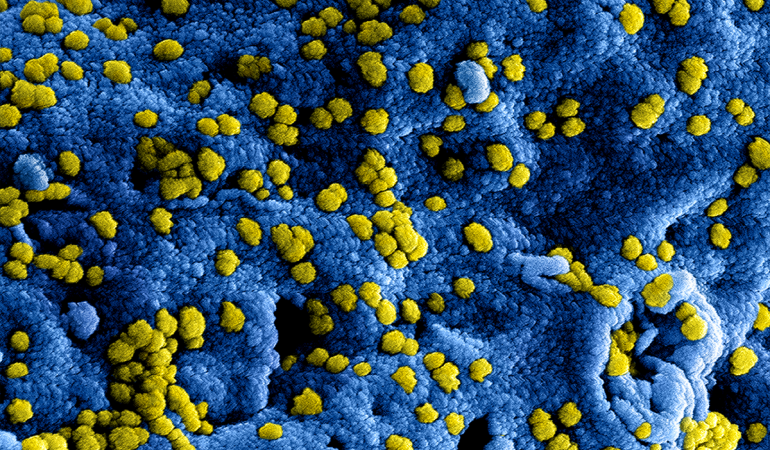 Het coronavirus leidt tot veel vragen, ook binnen Valkenhof. Lees de belangrijkste info en maatregelen op onze website: valkenhof.nl/coronavirus-vr… 

#coronavirus #COVID19 #vragen #antwoorden