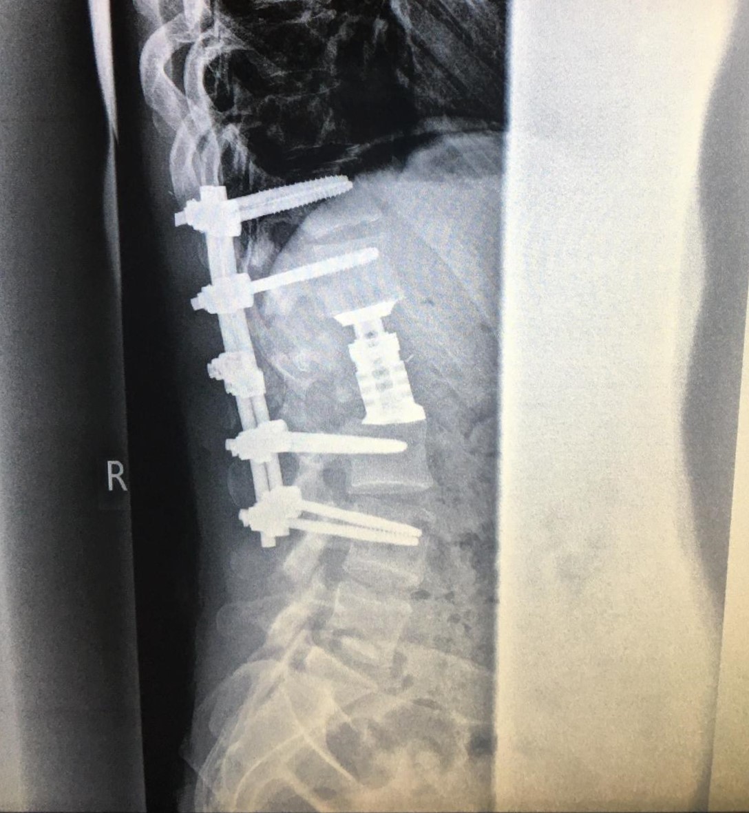 Salut moussaillon !
Notre équipage de pirates est en pleine preparation pour la #cdr2020. On a décidé de revisiter la classique jambe de bois, chez le pirate moderne le dernier chic c'est plutot la vertèbre de titane.