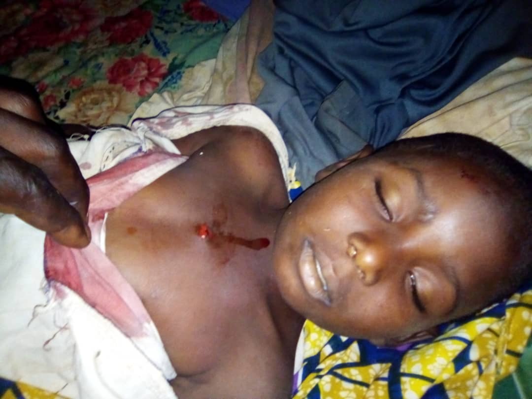 JaydenGlades's tweet photo. If #PaulBiya can do this to his own harmless CITIZENS and go free in this 21century, under the watch of @UNHumanRights @amnesty @IntlCrimCourt @AsstSecStateAF @USEmbYaounde , then you're all complice to #GenocideInSouthernCameroons and we the #Ambazonians will remeber you as such https://t.co/UARLlW8AzO
