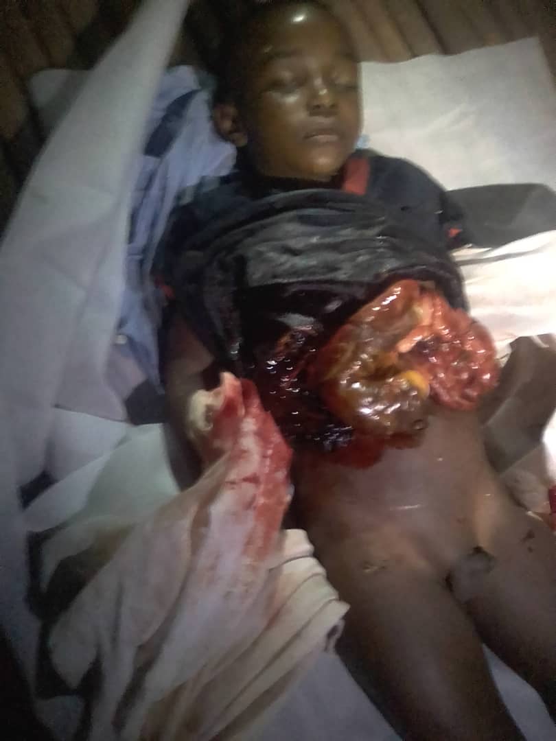 JaydenGlades's tweet photo. If #PaulBiya can do this to his own harmless CITIZENS and go free in this 21century, under the watch of @UNHumanRights @amnesty @IntlCrimCourt @AsstSecStateAF @USEmbYaounde , then you're all complice to #GenocideInSouthernCameroons and we the #Ambazonians will remeber you as such https://t.co/UARLlW8AzO