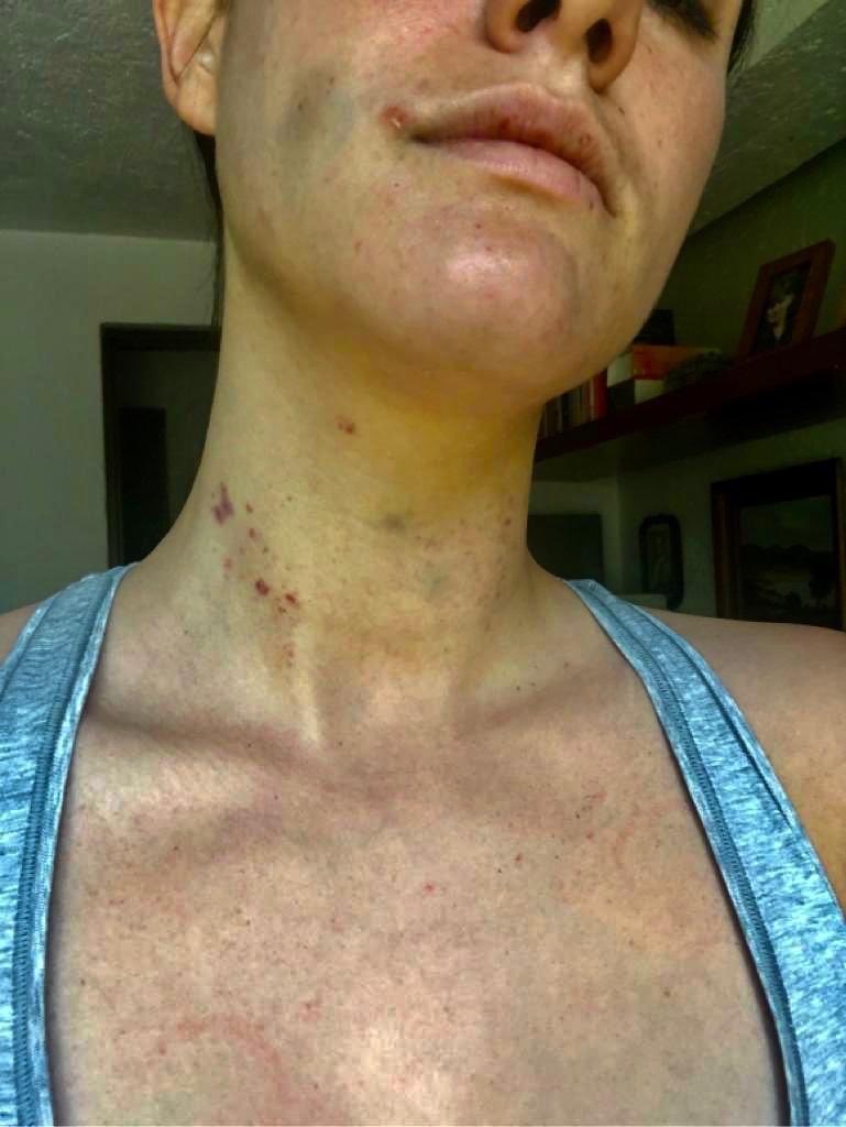 AlessandraRdlv's tweet photo. Alexandro Struck Azcárraga, nieto Del dueño de Grupo Fórmula, madreo a su novia y el huyo del país. 

Quiero imaginarme que la Interpol ya tiene ficha roja para encontrarlo y traerlo de los pelos a su país.

¿Cuánta más impunidad? 
No vamos a tolerar una sola. https://t.co/A6o0qyUoFr