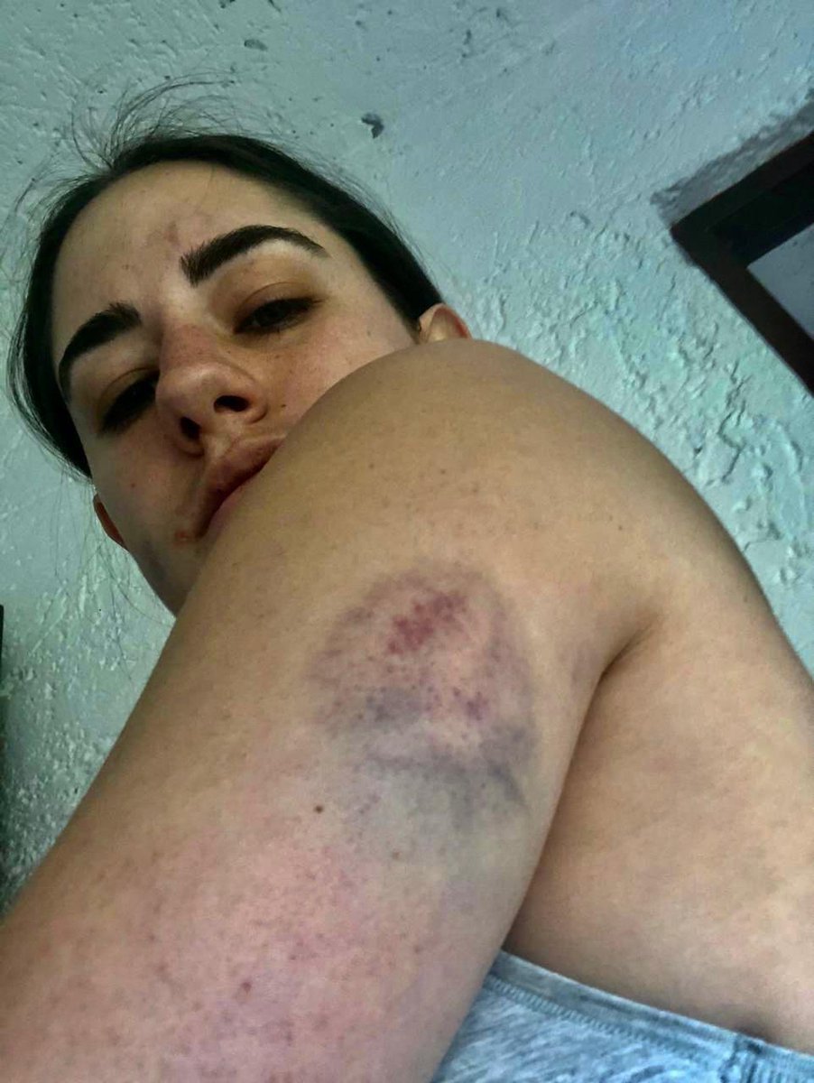 AlessandraRdlv's tweet photo. Alexandro Struck Azcárraga, nieto Del dueño de Grupo Fórmula, madreo a su novia y el huyo del país. 

Quiero imaginarme que la Interpol ya tiene ficha roja para encontrarlo y traerlo de los pelos a su país.

¿Cuánta más impunidad? 
No vamos a tolerar una sola. https://t.co/A6o0qyUoFr