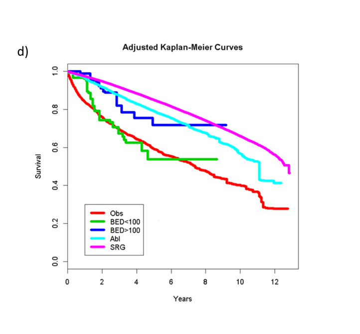 ASTRO_org's tweet photo. #AdvancesRO article in press: SBRT for the Definitive Treatment of Early Stage Kidney Cancer: A Survival Comparison with Surgery, Tumor Ablation, and Observation https://t.co/nzS2q5Njqv #OpenAccess #radonc https://t.co/nAi17TNsjZ