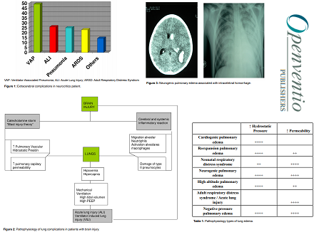 Prrmojeditor's tweet photo. #review #Pulmonary Complications in #patients with
#braininjury - https://t.co/nGh7KZ43i8

#Neurosurgery #Acutelunginjury #COPD #Neuroanesthesia #neonatalpulmonology #Pulmonaryrehabilitation #Lungfibrosispneumonia #Pulmonaryhypertensionasthma #Headachedisorders https://t.co/V7jK3tOFdi