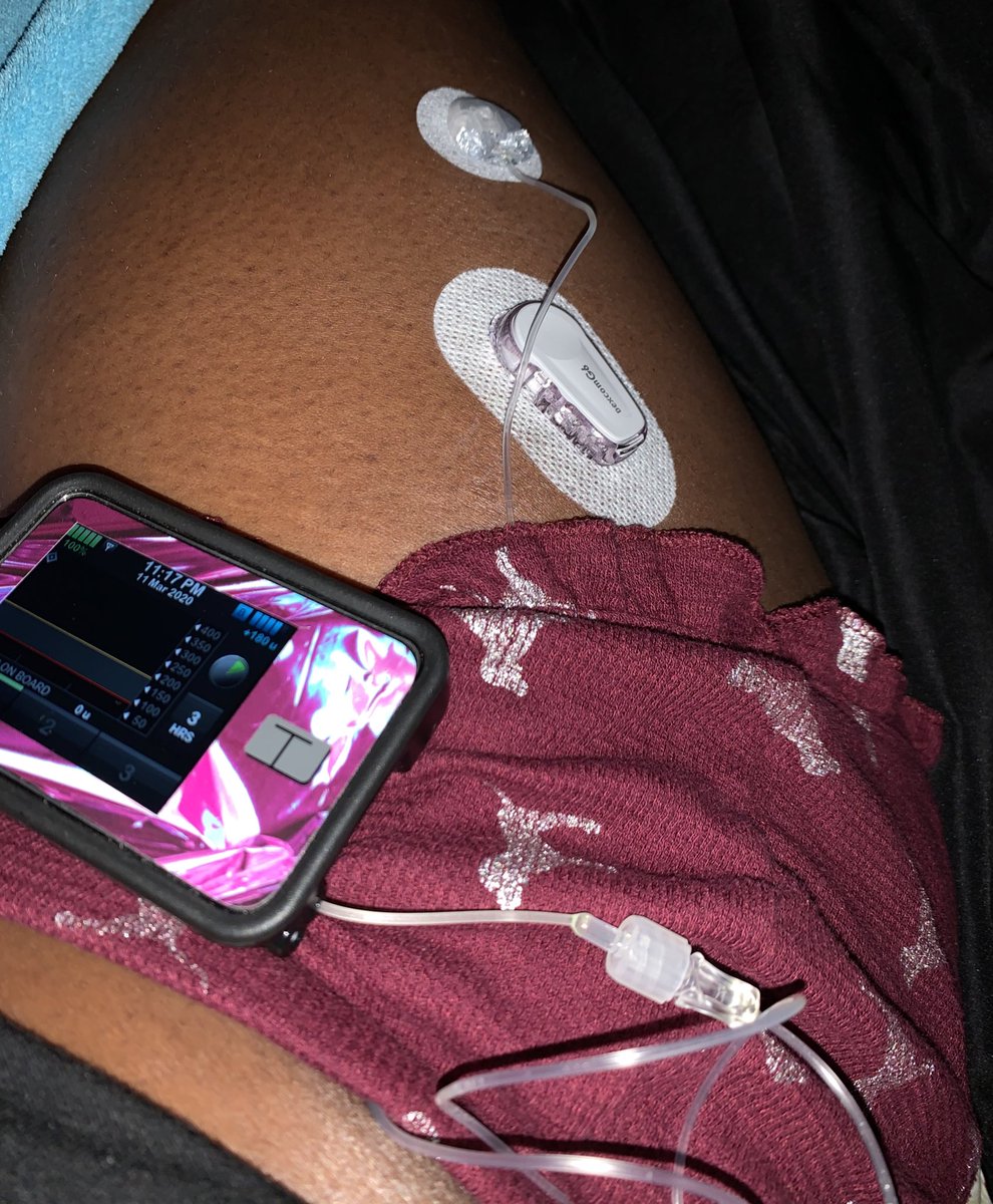 DarkVisenya7's tweet image. New sites😍📲📟🩸
#T1D #TSlimx2 #controliq #dexcomg6  #BlackDiabeticGirl