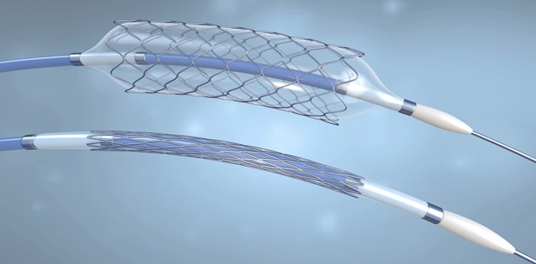 attorneygroup's tweet photo. FDA: Recall Issued for Abbott NC Trek RX and NC Traveler RX Coronary Dilatation Catheters - https://t.co/4zX41Y0a6n https://t.co/nlhJf2MGjc