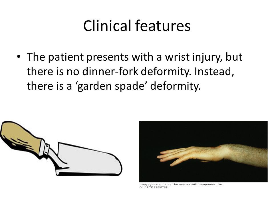 Smith Fracture Garden Spade