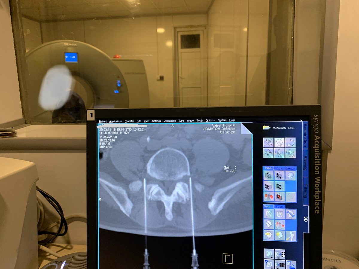 SUHAIBa2t's tweet photo. nerve root infiltration #pairs2020 #pairsmedia #interventionalradiology #painmanagement https://t.co/O9VaGZ8Bvr