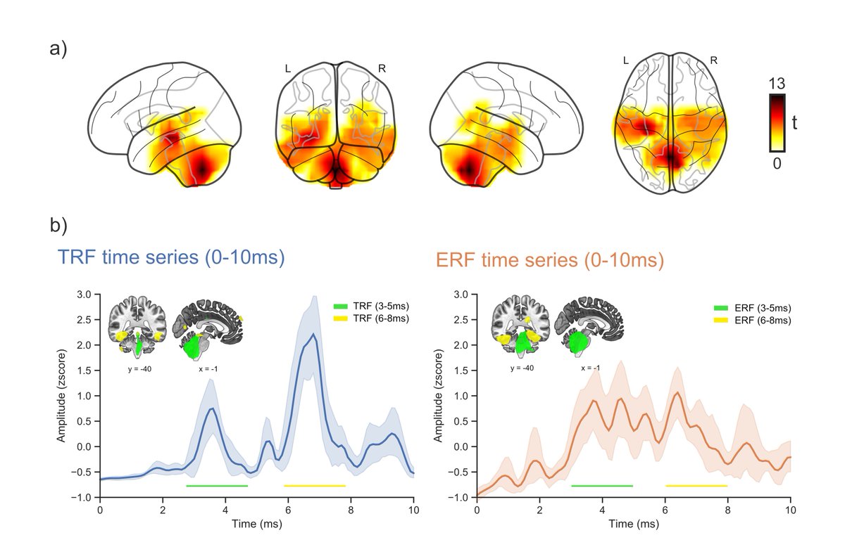 The sources of measured and forward modelled brainstem activity correlate strongest in subcortical and medial temporal regions crossing the auditory pathway. Additionally both modelled and measured signals show a spread of activity from lower to higher order processing areas 2/4