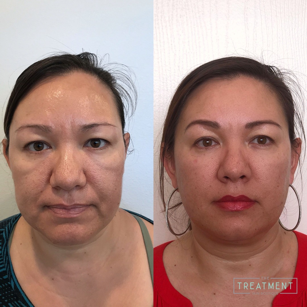 Dermasweep tweet media