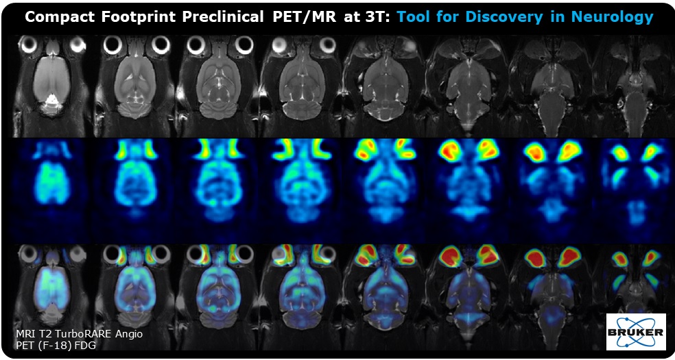 #preclinicalimaging #NeuroImaging #ratbrain #PETMR