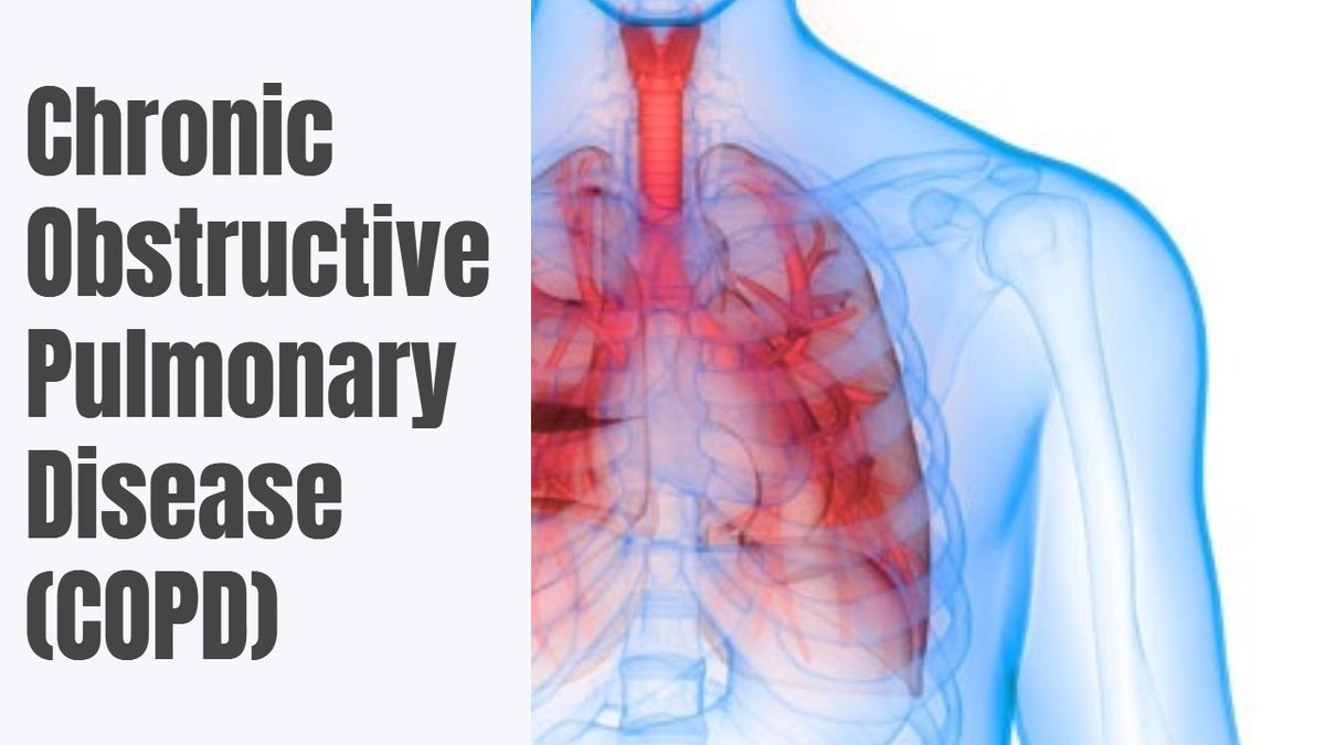 COPD_Conf's tweet photo. We Invite all the Eminent Speakers from worldwide to join for the "International conference on COPD and Asthma" coming up to Paris, France on 24th-25th of September 2020.
Theme: Encounter the advancements in the field of COPD and Asthma
#COPD #Asthma #Respiratorytrack #lungcancer https://t.co/J8ApU9ZsRc