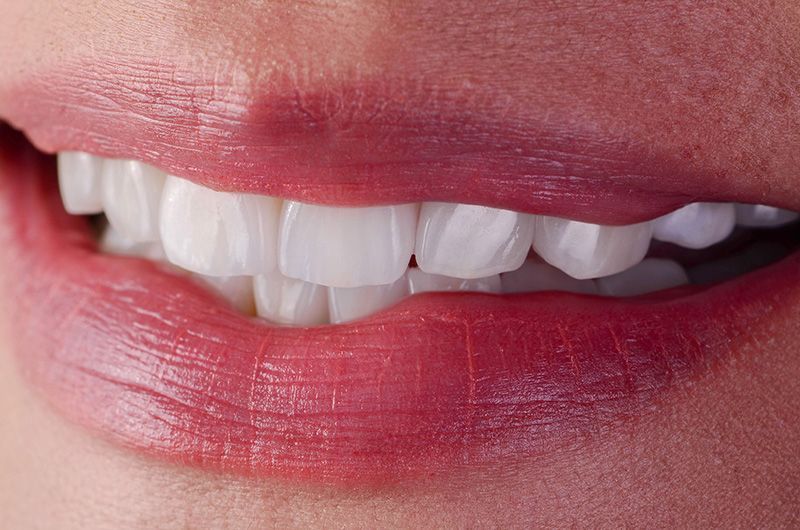 ArtLabDentistry's tweet photo. This is another beautiful ArtLab Dentistry restoration using a combination of veneers, crowns, implant crown, and a bridge. https://t.co/ug15tWBYA8 #dentalimplants #dentistry #porcelainveneers https://t.co/J8rRIlEj3f
