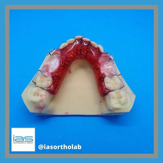 A sparkling Twin Block from out technician Kris today! Red with glitter and clear acrylic blocks from a printed model. Great work! 👏 
#twinblock #red #glitter #sparkle #orthodontic #dentalphotography #dentistry #teeth #smile ift.tt/2W9MQoH