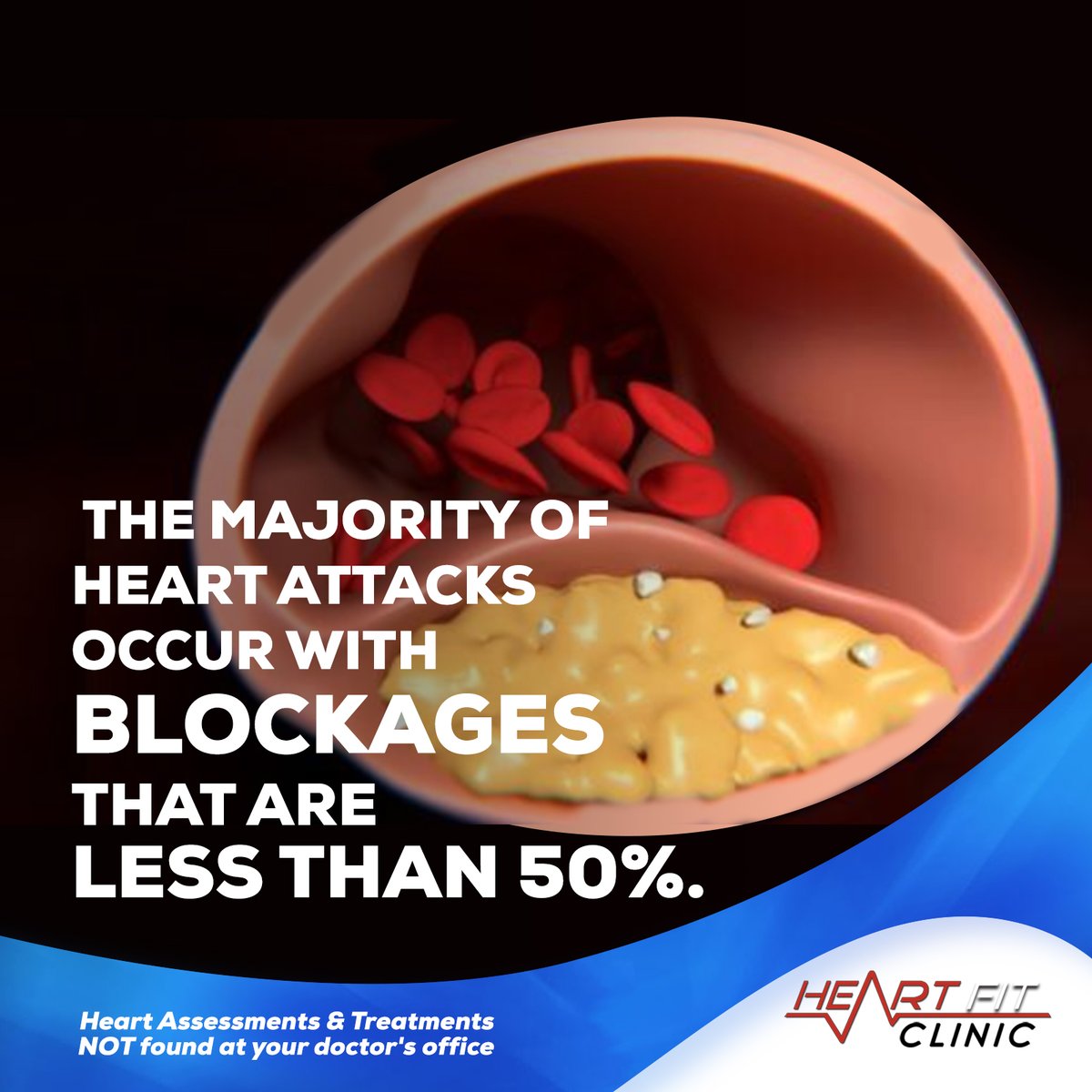 heartfitclinic's tweet photo. @HeartFit @heartfitclinic
Heart Assessments &amp; Treatments NOT found at your doctors office.
Visit us online at:
https://t.co/EzqCHaAl6P
or contact us on:
1-877-700-4348
#hearthealth #heart #cardiology #healthylifestyle #heartdisease #yyc #yychealth #yeg #alberta https://t.co/4OROIsDfFi