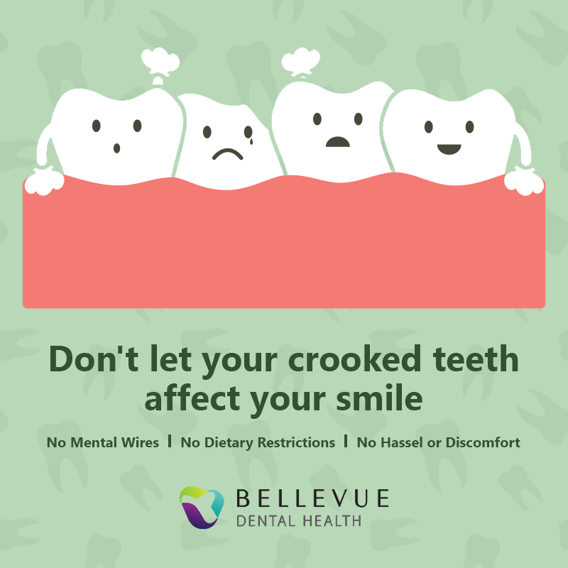 DrLibbiFinnessy's tweet photo. #Crookedteeth affect both your aesthetic as well as your #oralhealth. Our experienced team of #orthodontists can help you rediscover a straight #smile in no time. Call us at (425) 641-3311 to schedule an appointment, or visit  https://t.co/kq2aNR8Ppj. https://t.co/WY4zA5Wc0L