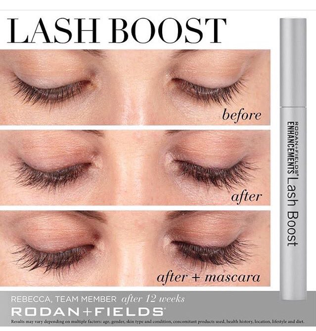 lauriesynchro's tweet image. Hey guys!  Who’s ready to have beautiful lush long, thick lashes👀...🍀Lucky for you there’s Lash Boost!🍀 

💚 R+F Lash Boost conditioning serum improves the appearance of lash volume, length and darkness - without a prescription - in as little as 8 weeks! 💚

💚 #LashBoost