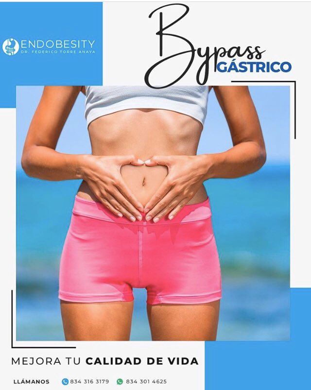 DrFedericoTorre's tweet image. #BypassGastrico #MangaGastrica #MiniBypass #Obesidad #Diabetes #EEUU #Texas #Houston #Dallas #SanAntonio #McAllen #Brownsville #Laredo #Harlingen #Edinburg #IsladelPadre #PuertoIsabel #Pharr #Weslaco #Mission #Mercedes #Hidalgo #Saltillo #Monterrey #Reynosa #Matamoros #Tampico