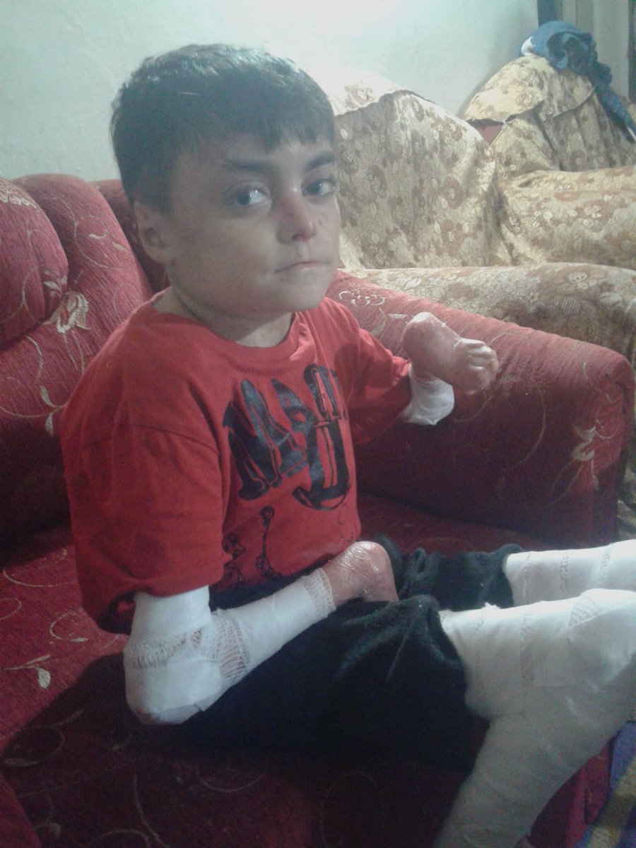 QUSAY_NOOR_'s tweet photo. My son Ahmed is 15 years old. He suffers from pemphigoid, and he needs special care and special foods. He and his mother entered the crossing into Turkey.  After a while, I went into Turkey illegally with our two other children, because his mother can not take care of Ahmed alone https://t.co/6j02RGrry7