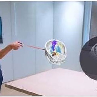 3dheals's tweet photo. UK cancer patients use Brainlab mixed reality viewer to visualize, understand their treatment @NewsMedical @Brainlab #MixedRealityViewer #GenesisCare #cancercare #medicalimaging #technology #healthcare #Diagnostics #NextGeneration #oncology #JointheTr… https://t.co/GezCKzKXbx https://t.co/wYIrORjhJW