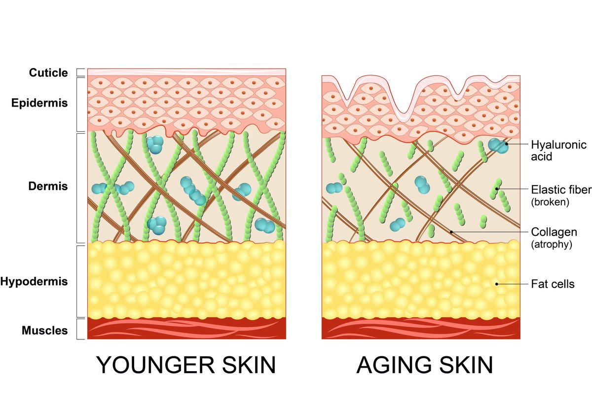 DichotomyofB's tweet photo. IS COLLAGEN AN ANTIAGING MIRACLE?
https://t.co/Fu5gurex8s https://t.co/ZQ6p97OPOA