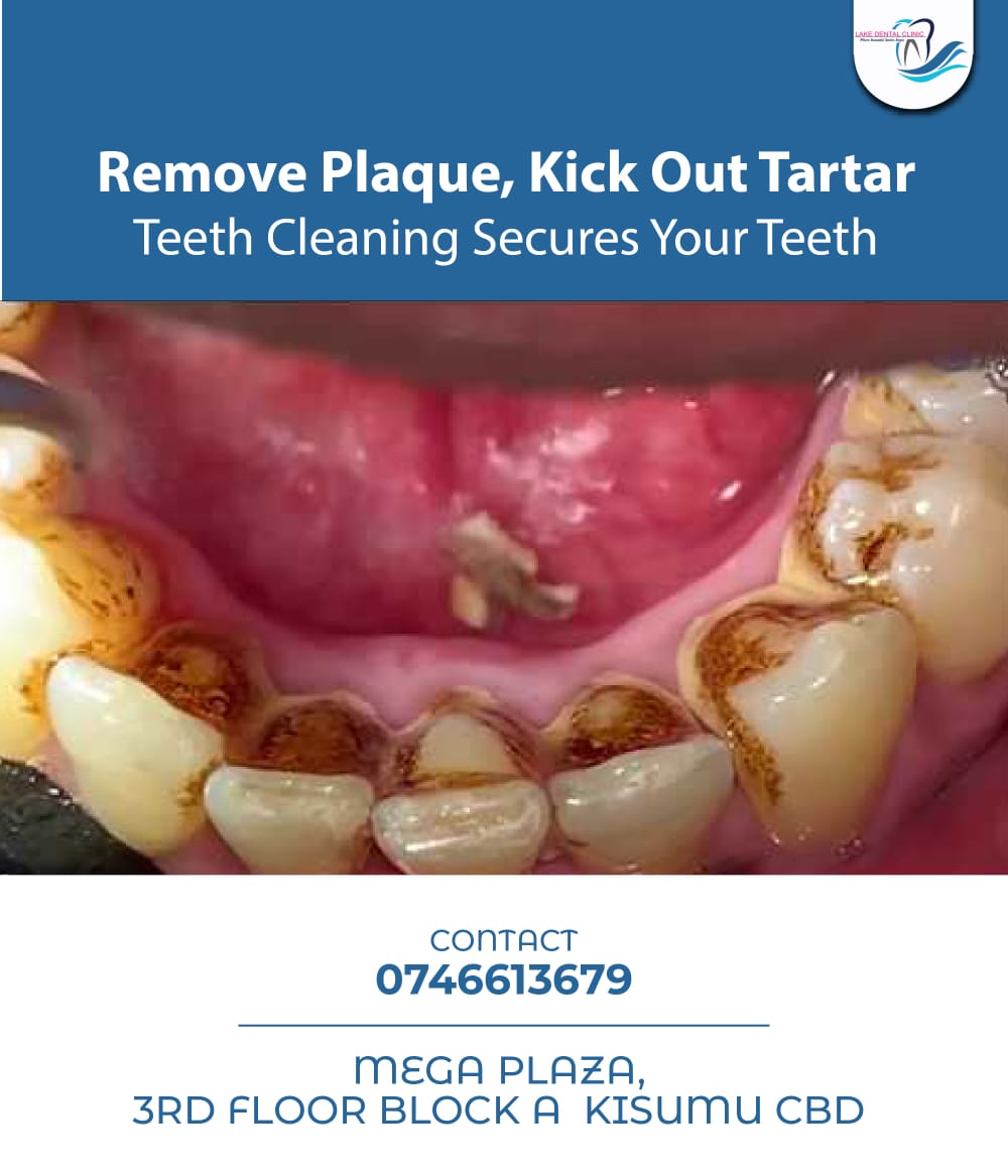 lakedentalke's tweet image. You can trust us for proper removal of #dental plaque from your teeth. Because we'd love to see your teeth secured from avoidable #cavities, #gingivitis and #periodontal disease we're ready to serve.

Call us : 0746613679
Visit us : Mega Plaza 3rd Floor (Block A) - #Kisumu CBD
