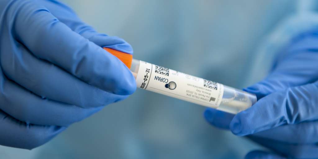 PaoloTognina's tweet photo. La #Predigerkirche, chiesa vetero-cattolica di #Basilea, diventa presidio sanitario per effettuare test su casi sospetti di #Coronavirus #Covid19 https://t.co/Yn3Q6UxMq5 https://t.co/WXkJskZd5Q