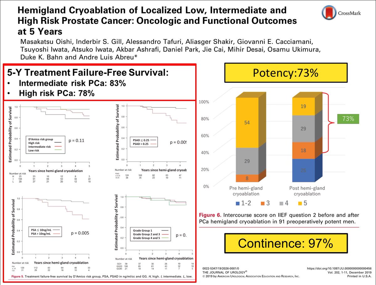Dr Andre Abreu (@aldcabreu) on Twitter photo Hemigland cryoablation of localized #prostatecancer provides effective midterm oncologic outcomes with good continence and potency. Higher baseline PSA density is risk factor for recurrence and treatment failure. <a href="/USC_Urology/">USC Urology</a> <a href="/FocalSociety/">Focal Therapy Society</a> <a href="/JUrology/">Journal of Urology</a> Hemigland cryoablation of localized #prostatecancer provides effective midterm oncologic outcomes with good continence and potency. Higher baseline PSA density is risk factor for recurrence and treatment failure. <a href="/USC_Urology/">USC Urology</a> <a href="/FocalSociety/">Focal Therapy Society</a> <a href="/JUrology/">Journal of Urology</a>