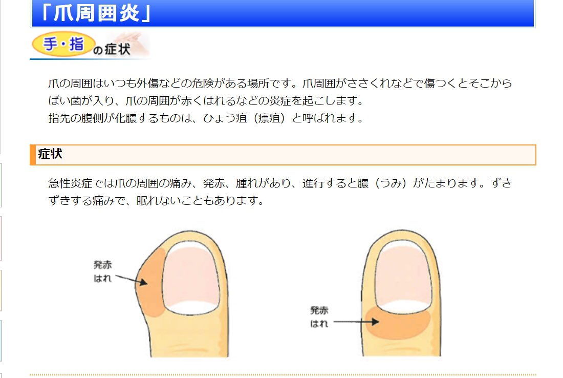 Aoking 都心部のフットサル サッカー団体 No Twitter やたら痛みがひどく膿がたまって歩くのも痛いのでググってみたらこれと症状が合致 病院行って薬もらわないと