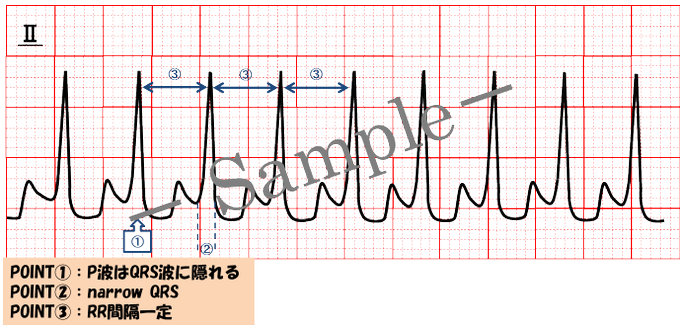 心電図イラストのtwitterイラスト検索結果