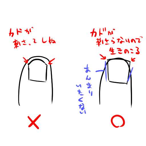 @tnsk7213 心得としてはこんな感じですの。あれだけ巻いてても普段は全く痛くないんですが、切り方間違えたり変なとこで割れたりすると化膿して腫れたりしてしぬ。気をつけましょう。 