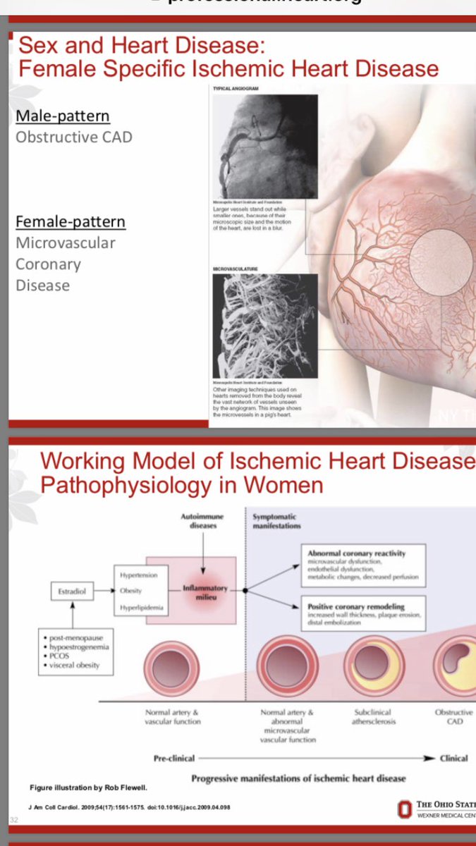 nrrn81's tweet photo. Gender differences in Cardiovascular Disease https://t.co/veaEQuV3tn