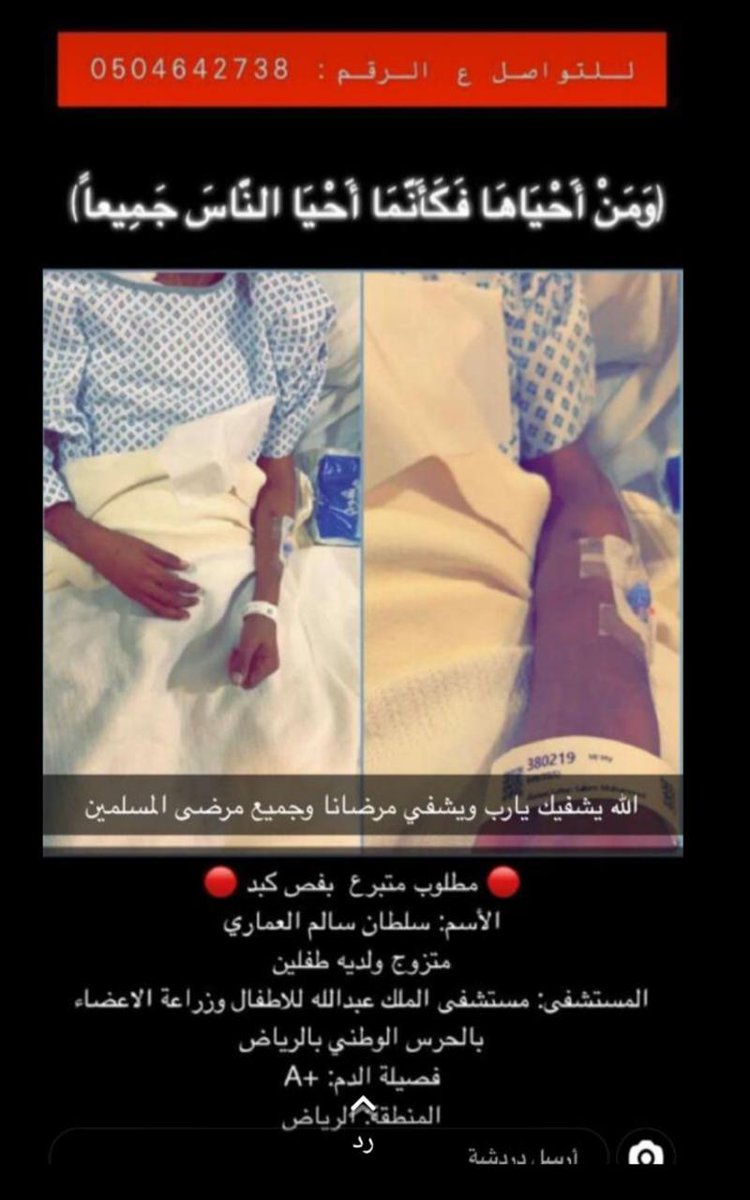 mssasj's tweet photo. #سلطان_العماري_محتاج_متبرع
سلطان العماري منوم في مستشفى الملك عبدالله للاطفال وزراعة الاعضاء بالحرس الوطني بالرياض ويحتاج متبرع بفص من الكبد نظراً لحالته الحرجه ، ارجو من الجميع دعم التاق ، فصيلة الدم +A

 #سلطان_العماري_محتاج_متبرع # https://t.co/W0ukXf9gPB