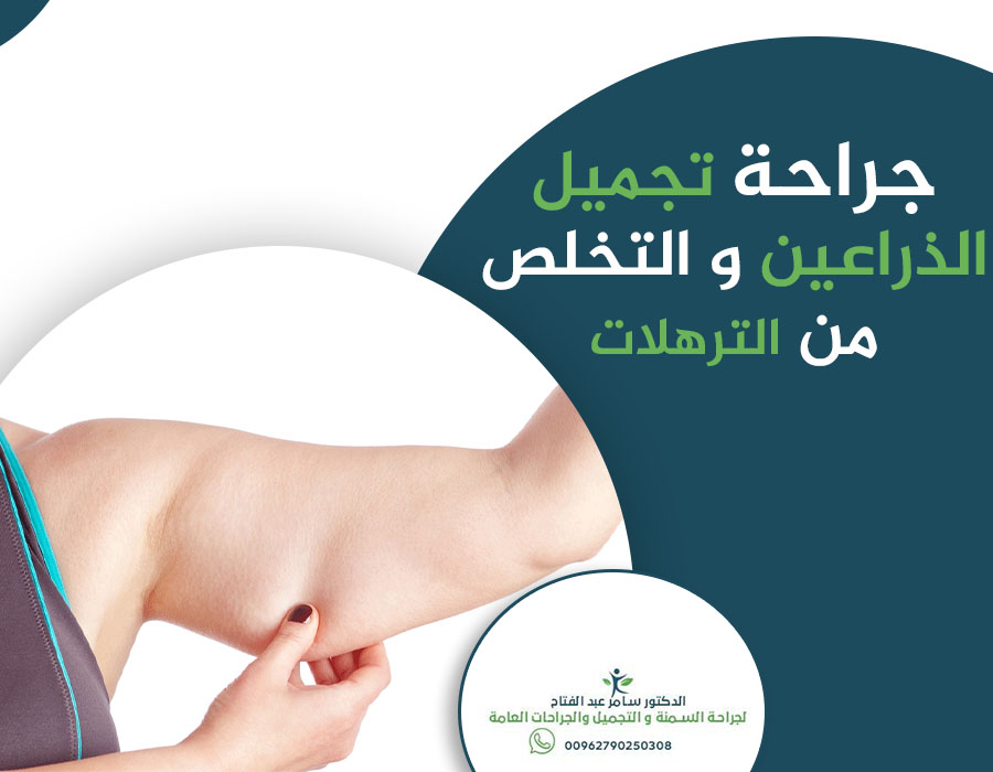 غالبا ما يتم اللجوء إلى #جراحة_تجميل_الذراعين عند فشل الطرق الأخرى لإزالة الجلد الزائد وتقوية العضلات.
أفضل طريقة لمنع بقاء الجلد الزائد في أعقاب الانخفاض الحاد في الوزن أو لتجميل الذراعين,هي ممارسة الرياضة التي تركز على عضلات الذراع والكتف, خلال عملية #فقدان_الوزن.
#تكميم #متكمم