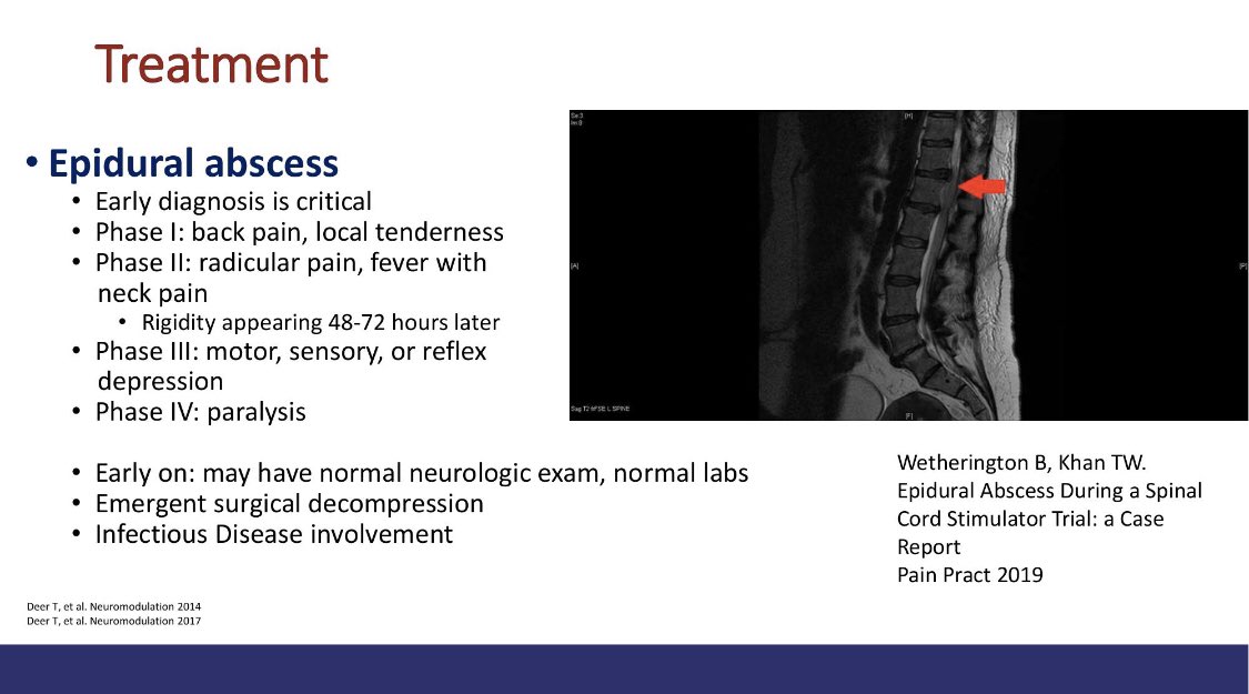 SMoeschlerMD's tweet photo. Epidural abscess requires early diagnosis, emergent surgical decompression and ID involvement. -@SNeumanMD, @NarouzeMD @AmerAcadPainMed #AAPM2020 https://t.co/j87xF1JbU6