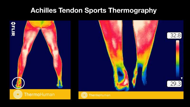 ThermoHuman's tweet photo. More info ⬆️ @SimpliFaster https://t.co/apwOASJG9N