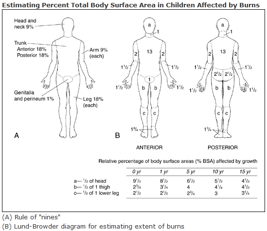 afidbrilliana's tweet photo. Kumpulan "Rule of" di bidang Bedah.

1. Wallace Rule of Nine / Burn Injury for Adults
Ada 11 part x 9 = 99%
Perineum = 1%

Notes:
• Versi lebih detail (Infant) pakai "Lund and Browder Chart"
• Luka <15% atau >85%, pakai "Palmar Method". Palmarnya pasien. Detail di gambar. https://t.co/t8mAYtrWg6