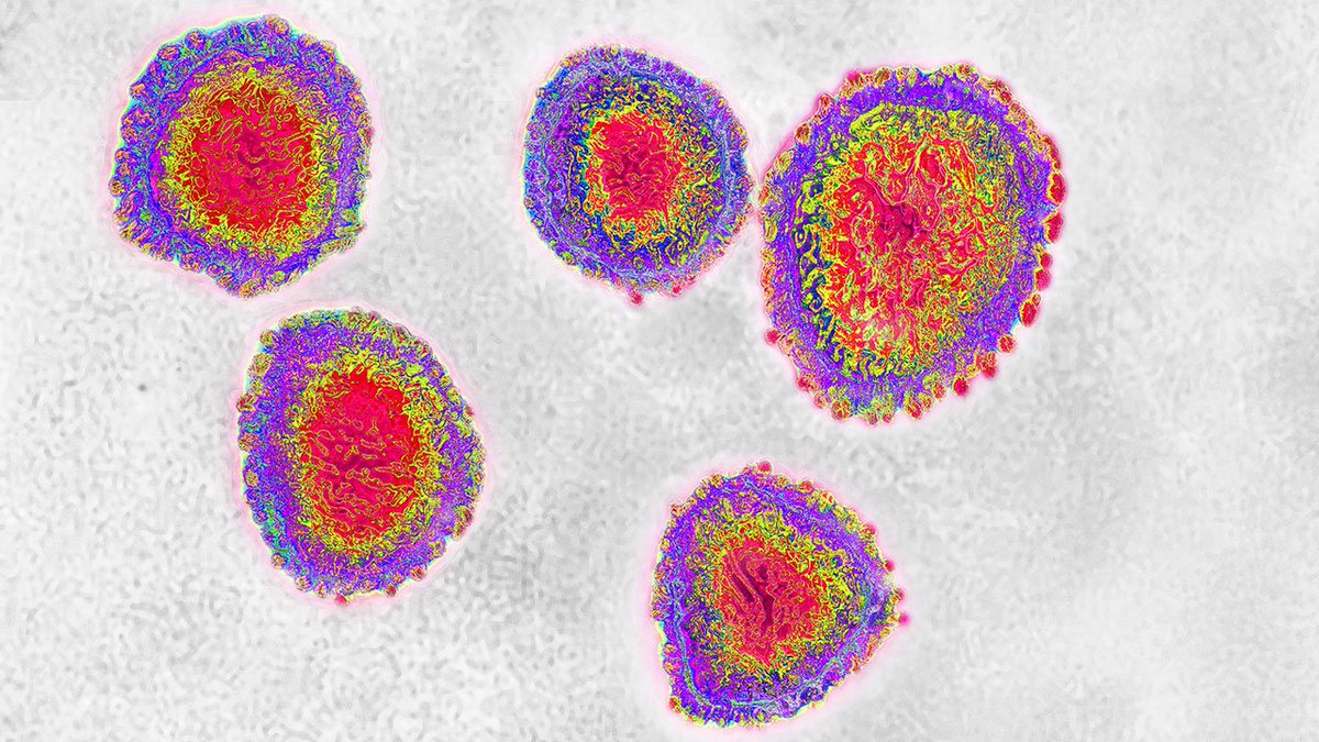 GSISP's tweet photo. Brasil confirma segundo caso de coronavirus: Ministerio de Salud https://t.co/skKBnv4GWm https://t.co/Tv6t21b4YO