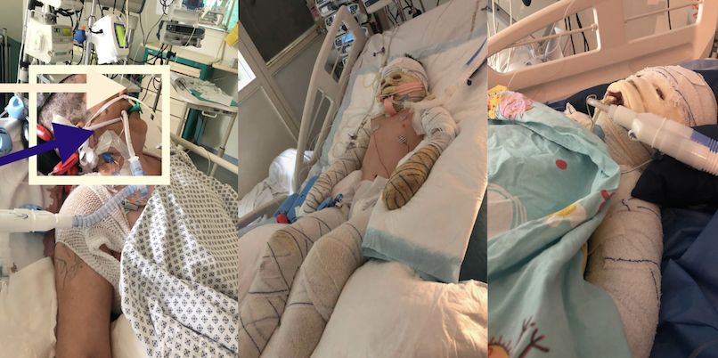 Virginie Cilia On Twitter Nous Sommes Le 1er Mars Deux Semaines Sont Passees Ma Mere N Arrive Plus A Respirer Elle Se Reveille Avec Grande Difficulte Et Les Medecins Preferent La Laisser Dans