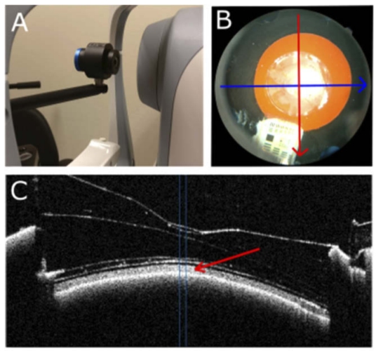 Crabb Lab Research (@crabblab) on Twitter photo A lot of hard work by <a href="/g_ometto/">Giovanni Ometto</a> and <a href="/GiovMontesano/">Giovanni Montesano</a> with <a href="/Egret_plus/">Egret Plus</a> fellow Tuomas Heikka for our new BOEx article <a href="/OSAPublishing/">Optica Publishing Group</a> #OSA_BOEx.
Testing a phantom eye under various signal-to-noise ratio conditions using eleven different #OCT devices
osapublishing.org/boe/abstract.c… A lot of hard work by <a href="/g_ometto/">Giovanni Ometto</a> and <a href="/GiovMontesano/">Giovanni Montesano</a> with <a href="/Egret_plus/">Egret Plus</a> fellow Tuomas Heikka for our new BOEx article <a href="/OSAPublishing/">Optica Publishing Group</a> #OSA_BOEx.
Testing a phantom eye under various signal-to-noise ratio conditions using eleven different #OCT devices
osapublishing.org/boe/abstract.c…