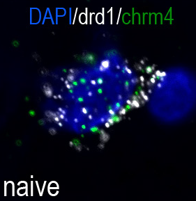 Putting rats on long term alcohol gives the same result - down-regulation of M4 mAChR only in the dorsolateral striatum (not dorsomedial).For RNAscope fans, we see this specifically on dopamine D1 positive spiny projection neurons (rather than ChAT-positive interneurons).