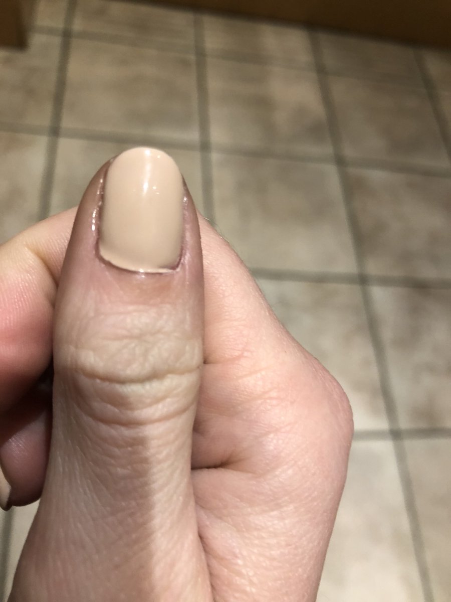 always concerned tweet media