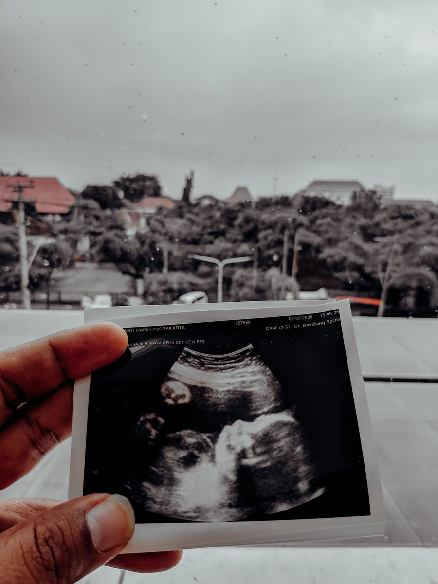 PowerRenda's tweet photo. Update foto anak dulu.... #28week https://t.co/lq4u3AMdS1