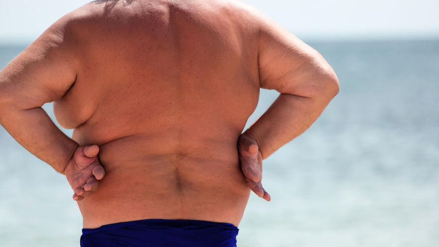 ожирение спины