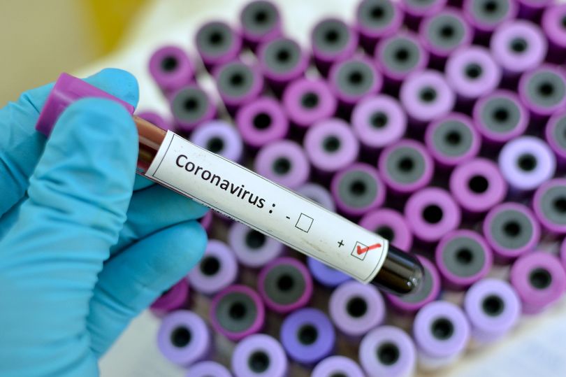 Coronavirus experts explain your chance of dying from the virus