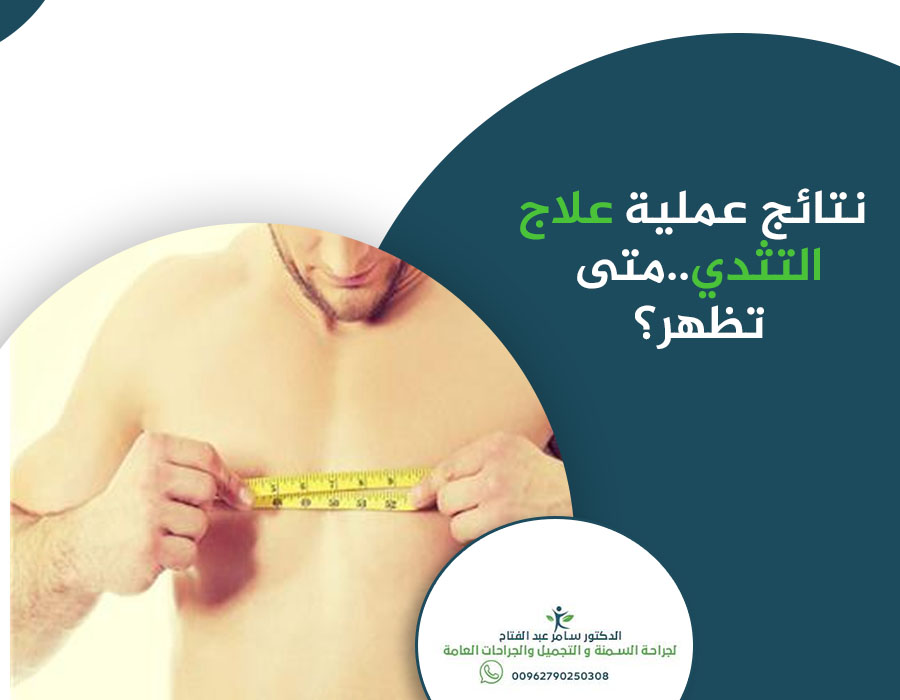 تظهر نتائج #عملية_علاج_التثدي فوراً، وتكون #الندوب التي تتركها #العملية #صغيرة للغاية وتختفي بسرعة #كبيرة. لكن النتائج #النهائية للعملية تستغرق عدة أشهر حتى يزول #التورم.
#الندوب التي تحدث في العملية لا بد من وجودها، لكن #الطبيب يحاول إخفائها قدر الإمكان.
#الدكتور_سامر_عبدالفتاح