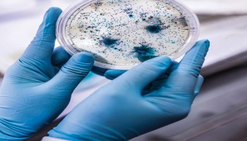 Khobaib 

مرض غامض في #اثيوبيا
 تصفر عيونهم وينزفون قبل وفاتهم

قالت صحيفة الديلي ميل البريطانية الأ...