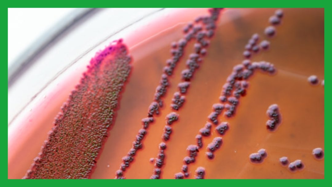 Alex_Verbeek's tweet photo. 🧫 

Good news:

A machine-learning algorithm has identified a new antibiotic compound that kills strains of bacteria that are resistant to all known antibiotics.

🧪 

#science #health #antibiotics #GoodNews 

➡️ https://t.co/g3PoyFV3zt https://t.co/fKtU7SOC81